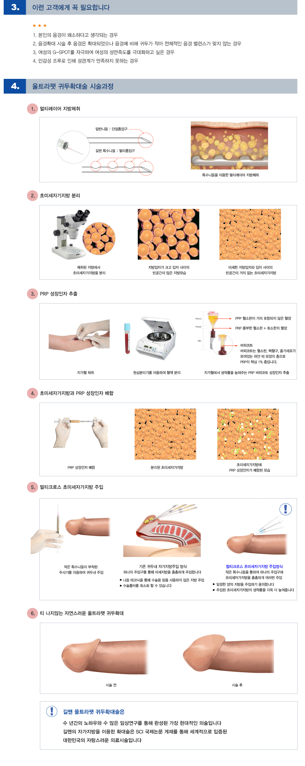 울트라팻 귀두확대